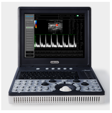 便攜式全數字彩色多普勒超聲診斷系統d3.