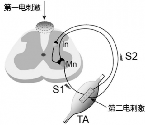 體外脊髓神經刺激測試系統3599