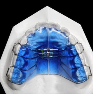 華偉定制式矯治器擴弓型、矯治保持型、牙膠片型