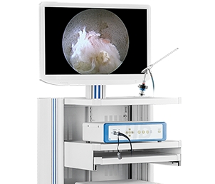 冠龍醫用內窺鏡攝像系統ys-i